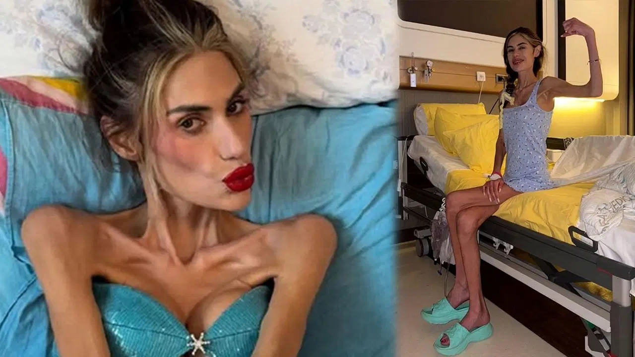 Nihal Candan 25 kiloya düştü, yoğun bakıma alındı! Ailesi vasilik başvurusu yaptı
