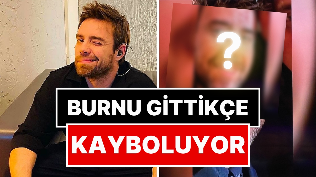 We Thought It Was Over: It Turns Out That Murat Dalkılıç, Whose Trouble with His Nose Never Ended, Had His 12th Surgery!